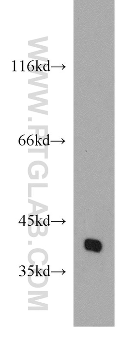 POU4F2 Rabbit Polyclonal Antibody, Proteintech Unconjugated; 20 &mu;L:Antibodies,