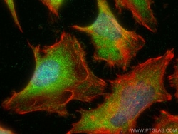 PPP1CC Rabbit Polyclonal Antibody, Proteintech:Antibodies:Primary Antibodies