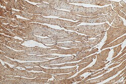 PPP1CC Rabbit Polyclonal Antibody, Proteintech:Antibodies:Primary Antibodies