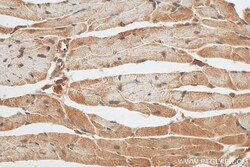 PPP1CC Rabbit Polyclonal Antibody, Proteintech:Antibodies:Primary Antibodies