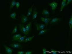 PPP1R17 Rabbit Polyclonal Antibody, Proteintech:Antibodies:Primary Antibodies