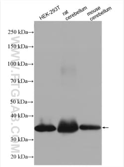 PPP1R3C Rabbit Polyclonal Antibody, Proteintech Unconjugated; 20 &mu;L:Antibodies,