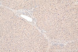 PPP2CA Mouse Monoclonal Antibody, Proteintech Unconjugated; 150 &mu;L:Antibodies,
