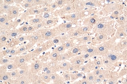 PPP2CA Mouse Monoclonal Antibody, Proteintech Unconjugated; 150 &mu;L:Antibodies,