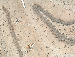 PPP2R2A/B/C Mouse Monoclonal Antibody, Proteintech:Antibodies:Primary Antibodies