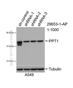 PPT1 Rabbit Polyclonal Antibody, Proteintech Unconjugated; 150 &mu;L:Antibodies,