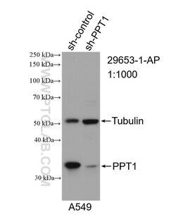 PPT1 Rabbit Polyclonal Antibody, Proteintech Unconjugated; 150 &mu;L:Antibodies,