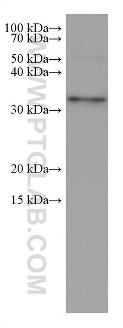 PPT1 Mouse Monoclonal Antibody, Proteintech Unconjugated; 150 &mu;L:Antibodies,