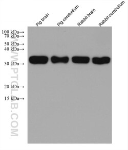 PPT1 Mouse Monoclonal Antibody, Proteintech Unconjugated; 150 &mu;L:Antibodies,