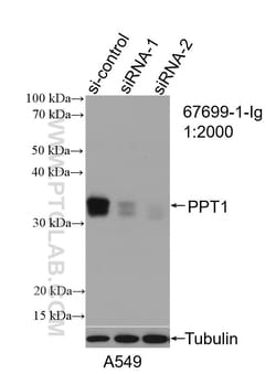 PPT1 Mouse Monoclonal Antibody, Proteintech Unconjugated; 150 &mu;L:Antibodies,