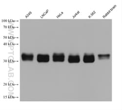 PPT1 Mouse Monoclonal Antibody, Proteintech Unconjugated; 150 &mu;L:Antibodies,