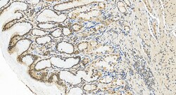 PRDM16 Rabbit Polyclonal Antibody, Proteintech Unconjugated; 150 &mu;L:Antibodies,