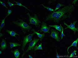 PRKAR2A Mouse Monoclonal Antibody, Proteintech Unconjugated; 150 &mu;L:Antibodies,