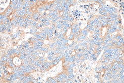 PRKAR2A Mouse Monoclonal Antibody, Proteintech Unconjugated; 150 &mu;L:Antibodies,