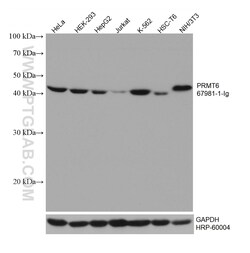 PRMT6 Mouse Monoclonal Antibody, Proteintech:Antibodies:Primary Antibodies