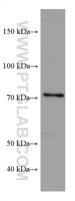 PRMT7 Mouse Monoclonal Antibody, Proteintech Unconjugated; 150 &mu;L:Antibodies,