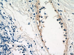 PROCR Mouse Monoclonal Antibody, Proteintech Unconjugated; 20 &mu;L:Antibodies,