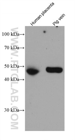 PROCR Mouse Monoclonal Antibody, Proteintech Unconjugated; 20 &mu;L:Antibodies,