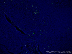 CoraLite Plus 488-conjugated PRTN3 Mouse Monoclonal Antibody, Proteintech