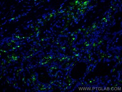 CoraLite Plus 488-conjugated PSAP Mouse Monoclonal Antibody, Proteintech:Antibodies:Primary