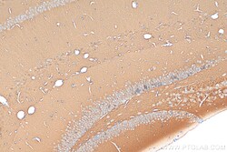 PSD95 Rabbit Polyclonal Antibody, Proteintech:Antibodies:Primary Antibodies