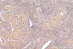 PSMA2 Mouse Monoclonal Antibody, Proteintech:Antibodies:Primary Antibodies