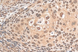 PSMA2 Mouse Monoclonal Antibody, Proteintech:Antibodies:Primary Antibodies