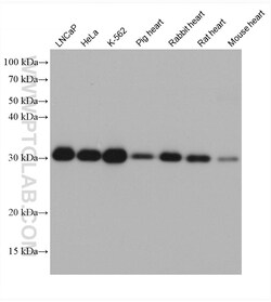 PSMA4 Mouse Monoclonal Antibody, Proteintech Unconjugated; 150 &mu;L:Antibodies,