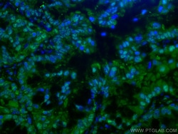 PSMA6 Mouse Monoclonal Antibody, Proteintech Unconjugated; 20 &mu;L:Anticuerpos