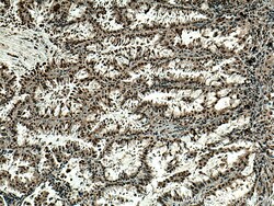 PSMA6 Mouse Monoclonal Antibody, Proteintech Unconjugated; 20 &mu;L:Anticuerpos