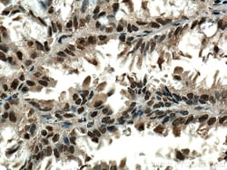 PSMA6 Mouse Monoclonal Antibody, Proteintech Unconjugated; 20 &mu;L:Anticuerpos