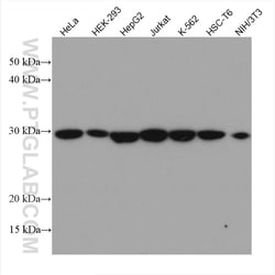 PSMA6 Mouse Monoclonal Antibody, Proteintech Unconjugated; 20 &mu;L:Anticuerpos
