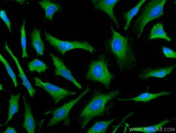 PSMA7 Mouse Monoclonal Antibody, Proteintech:Antibodies:Primary Antibodies