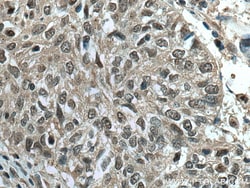 PSMA7 Mouse Monoclonal Antibody, Proteintech:Antibodies:Primary Antibodies