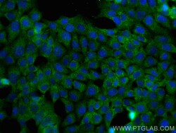 PSMB2 Mouse Monoclonal Antibody, Proteintech Unconjugated; 20 &mu;L:Antibodies,