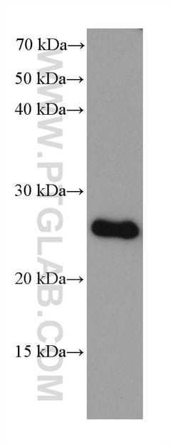 PSMB2 Mouse Monoclonal Antibody, Proteintech Unconjugated; 20 &mu;L:Antibodies,