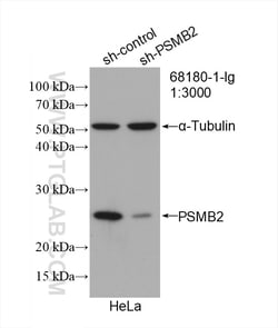 PSMB2 Mouse Monoclonal Antibody, Proteintech Unconjugated; 20 &mu;L:Antibodies,