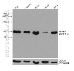 PSMB9 Mouse Monoclonal Antibody, Proteintech Unconjugated; 20 &mu;L:Antibodies,