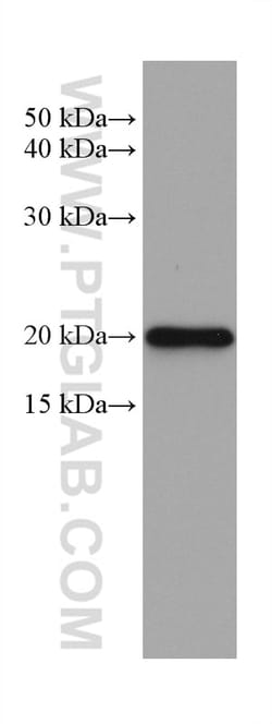 PSMB9 Mouse Monoclonal Antibody, Proteintech Unconjugated; 20 &mu;L:Antibodies,