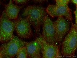 PSMD5 Mouse Monoclonal Antibody, Proteintech:Antibodies:Primary Antibodies