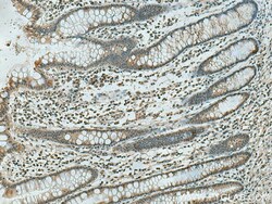 PSMD5 Mouse Monoclonal Antibody, Proteintech:Antibodies:Primary Antibodies