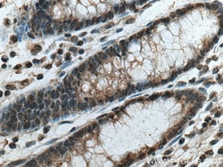PSMD5 Mouse Monoclonal Antibody, Proteintech:Antibodies:Primary Antibodies