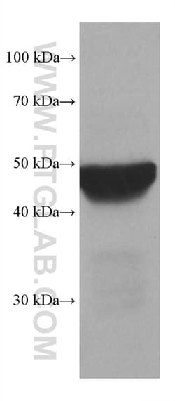 PSMD5 Mouse Monoclonal Antibody, Proteintech:Antibodies:Primary Antibodies