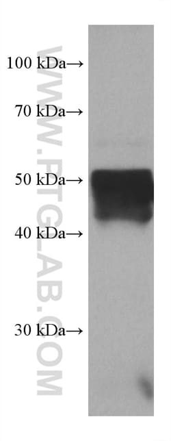 PSMD5 Mouse Monoclonal Antibody, Proteintech:Antibodies:Primary Antibodies