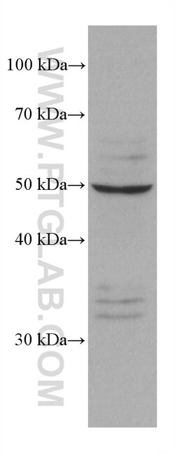 PSMD5 Mouse Monoclonal Antibody, Proteintech:Antibodies:Primary Antibodies