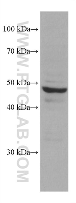 PSMD5 Mouse Monoclonal Antibody, Proteintech:Antibodies:Primary Antibodies
