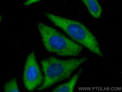 PTGES3 Mouse Monoclonal Antibody, Proteintech 150 &mu;L | Buy Online | Proteintech | Fisher Scientific