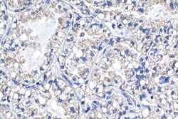 PTP4A1 Mouse Monoclonal Antibody, Proteintech Unconjugated; 20 &mu;L:Antibodies,
