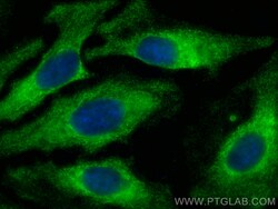 PTPN14 Mouse Monoclonal Antibody, Proteintech:Antibodies:Primary Antibodies