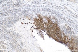 PTPN9 Rabbit Polyclonal Antibody, Proteintech:Antibodies:Primary Antibodies